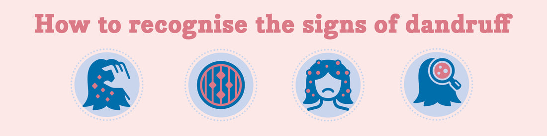Essano - How to recognise the signs of dandruff